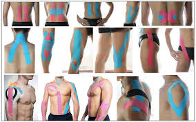 เทปบำบัดกล้ามเนื้อ Muscle Tape