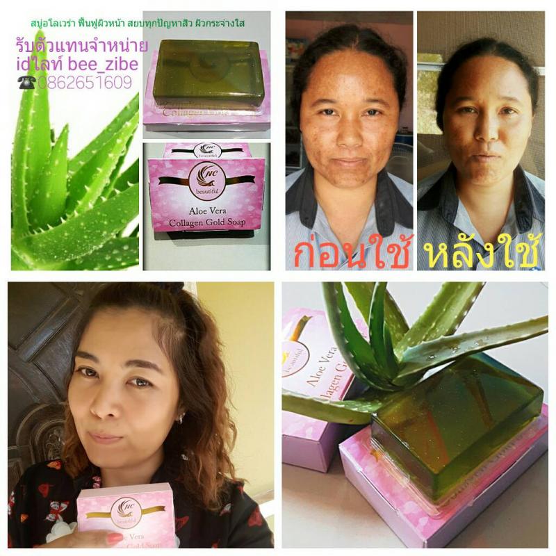 อยากผิวสวยหน้าใส ดีท็อกซ์ ลำไส้  ล้างสารพิษ แก้ปัญหาผิว สิวอักเสบ ฝ้า กระ จุดด่างดำ หน้าคล้ำ  ปัญหาเหล่านี้จะหมดไป แวะเลยคร่าา!! สิวอักเสบ ฝ้า กระ จุดด่างดำ หน้าคล้ำไม่สดใส ไปไหนเพื่อนทัก สบู่ว่านหางจรเข้กลูต้าผสมทองคำ ตอบโจทย์ทุกปัญหาผิว สบู่ว่านหางจรเข้กลูต้าผสมทองคำ ตอบโจทย์ทุกปัญหาผิว ช่วยฟื้นฟูผิวให้เปล่งปลั่งมีออร่า ด้วยส่วนผสมของว่านหางจรเข�