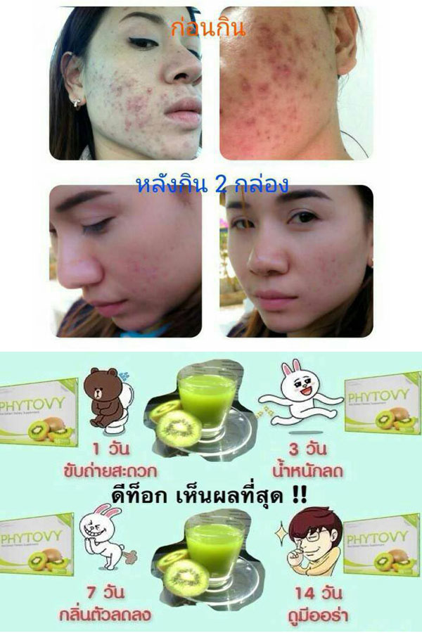 ผิวสวยหน้าใส ดีท็อกซ์ลำไส้ ล้างสารพิษ แก้ปัญหาผิว สิวอักเสบ ฝ้า กระ จุดด่างดำ หน้าคล้ำ ปัญหาเหล่านี้จะหมดไป แวะเลยคร่าา