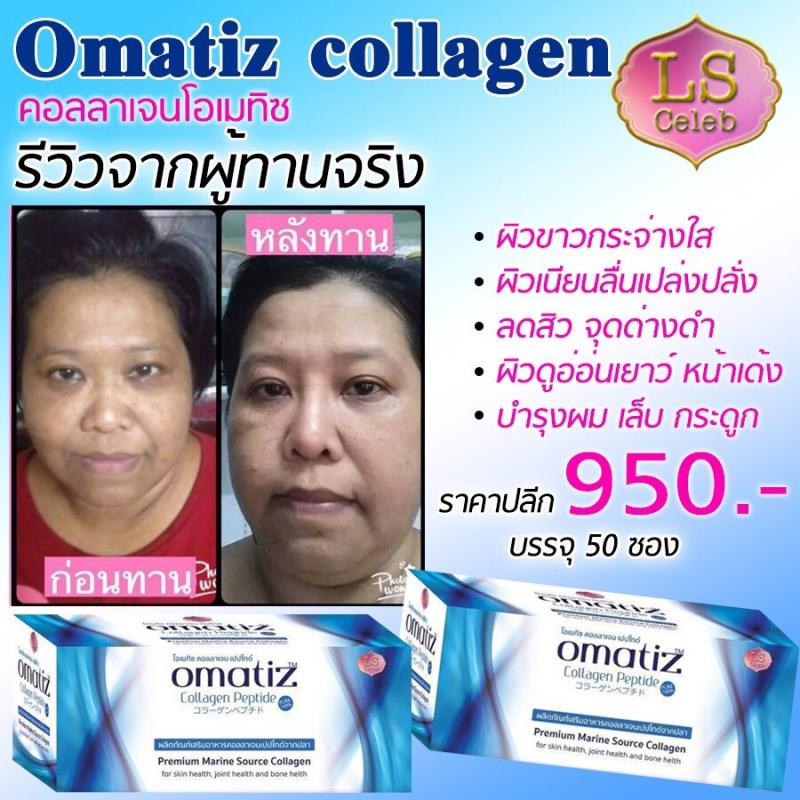 Omatiz Collagen Peptide
