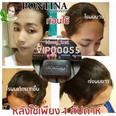 ร้าน สบู่รักษาผมร่วง พรทินา ปลีก-ส่ง