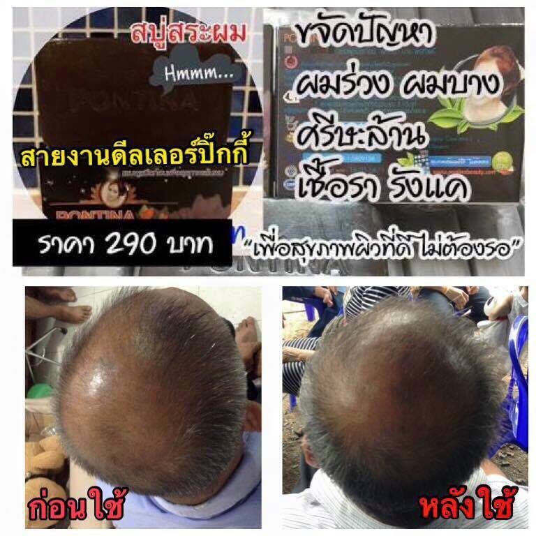 ร้าน สบู่รักษาผมร่วง พรทินา ปลีก-ส่ง