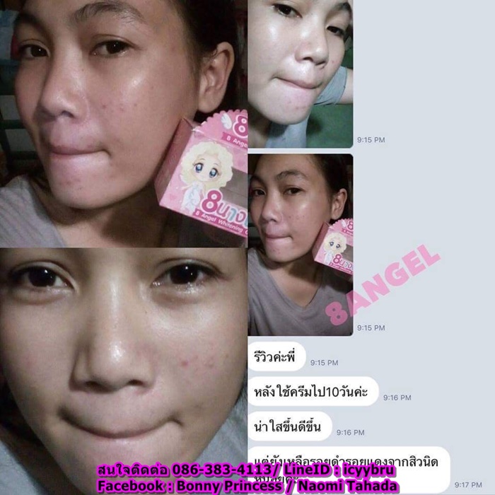 ใหม่ เปิดตัวชุดครีมหน้าใสไร้สิว By 8 นางฟ้า มาพร้อมครีมกันแดดหน้าวาว ครีมที่เน็ตไอดอลใช้มากที่สุด