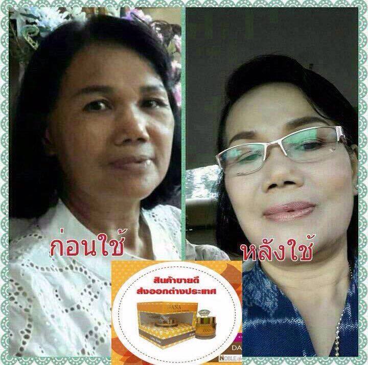 ครีมDANA