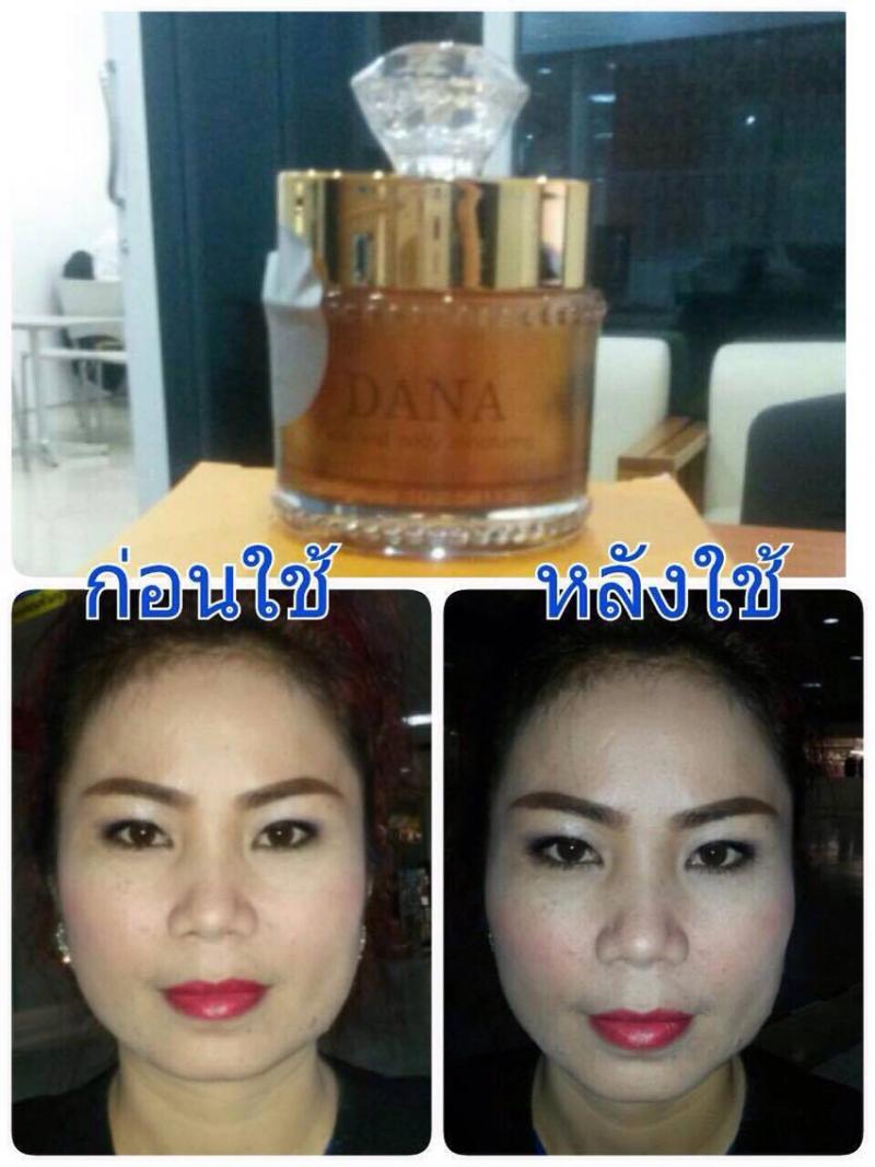 ครีมDANA