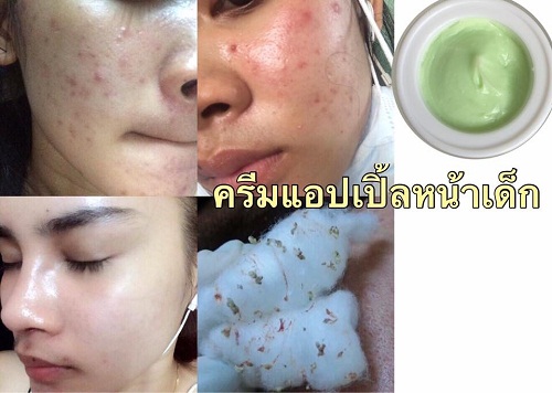 ครีมแอปเปิ้ลหน้าเด็ก เชต 3 กระปุก ราคาโปร 499 บาท