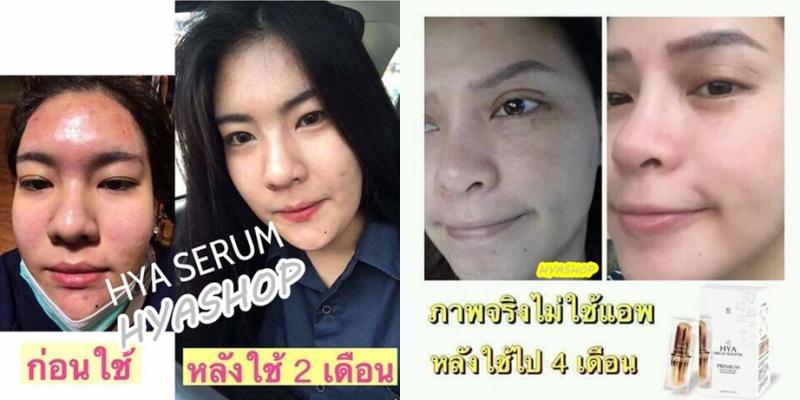 ไฮยา เซรั่มหน้าตึง