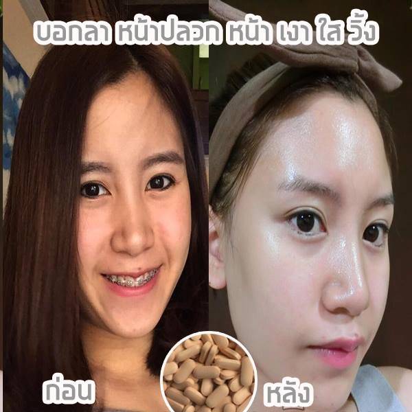 ผิวขาว หน้าเด้ง หน้าเด็ก หน้าเรียว ปลอดภัยเห็นผลจริงค่ะ
