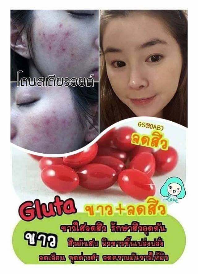 กลูต้าผิวขาว รกแกะหน้าเด้ง โบท็อกหน้าเรียว สมุนไพรกระชับภายใน